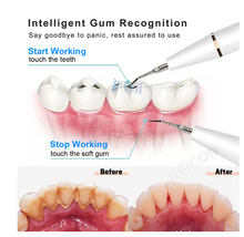 Load image into Gallery viewer, Dental Kit (Suitable for Animals)
